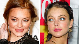 Lindsay Lohan chtěla mít smyslnější rty...
