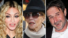Celebrity, které se hollywoodským úsměvem nepyšní.
