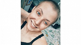 Vlasy i obočí jí po chemoterapiích rostou opravdu rychle.