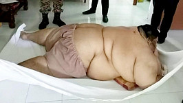 Morbidně obézní Malajsijec se projedl k úplné imobilitě... 