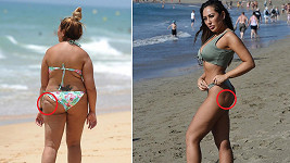 Před a po... Britská celebrita se rozčílila, když ji obvinili, že podstoupila liposukci.