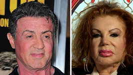 Kvůli plastikám jsou si Sylvester a jeho matka Jackie Stallone zase o kus podobnější...