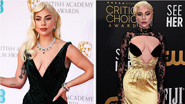 Lady Gaga zvládla dvě slavnostní akce během jednoho večera. 