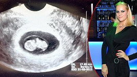 Ornella Štiková ukázala ultrazvuk.