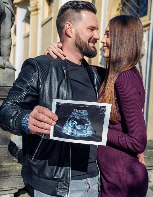 S partnerem Viktorem Hajíčkem budou mít dceru.