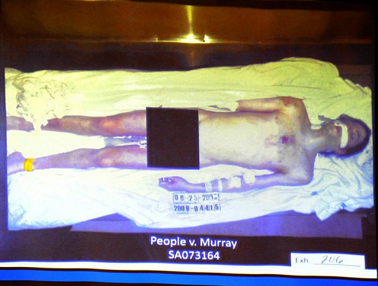 Snímek mrtvého vyhublého těla Michaela Jacksona.
