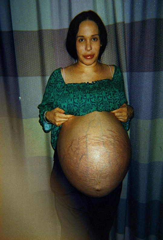 Těhotenské bříško s osmerčaty uvnitř vypadá následovně.