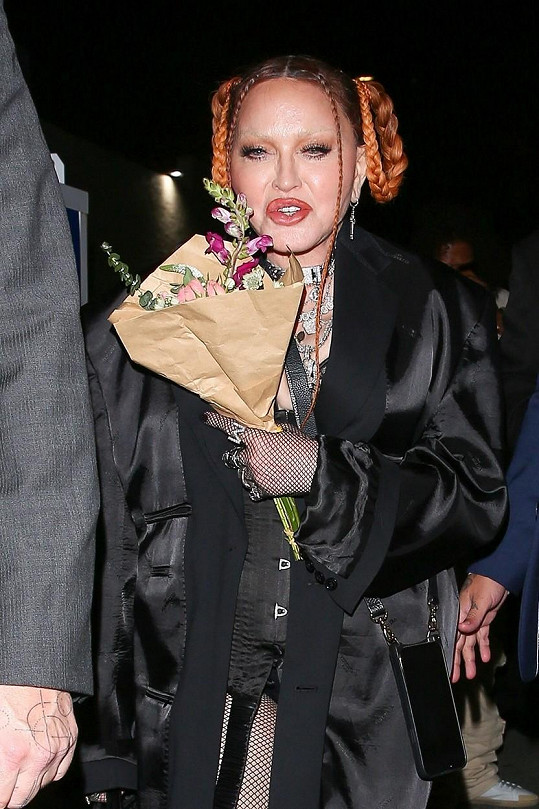 Madonna na snímku z nedávné doby. Teď už má zase obočí. 