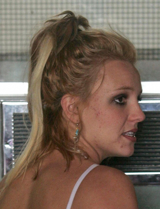 Není to nikdo jiný než hvězda slavící obrovský comeback Britney Spears. Fotografie je z roku 2004. Britney poznat byla, ne že ne... Ačkoliv adolescentní pupínky a mastný zevnějšek napovídaly, že neměla zrovna nejlepší období.
