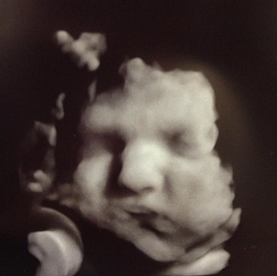 Quentin na fotce z ultrazvuku.