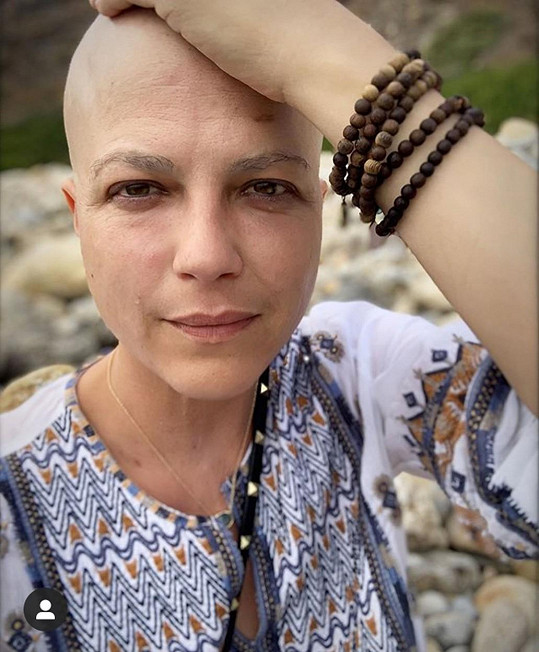 Chemoterapie, při níž přišla o vlasy, zabrala. 