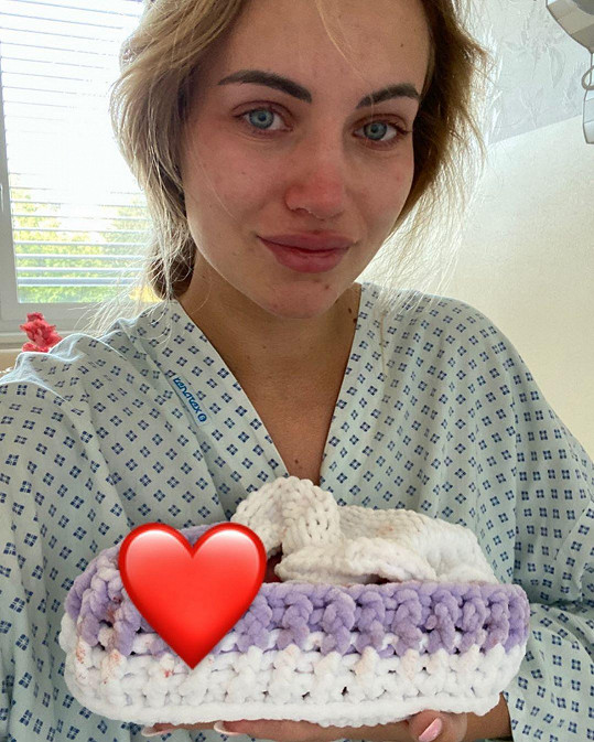 Natálie zveřejnila fotku se zesnulým miminkem v porodnici.