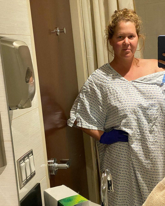 Amy Schumer se ozvala fanouškům po operaci endometriózy. 
