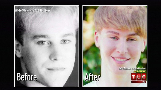 Toby před a po operacích, které jej vyšly na více než dva milióny korun.
