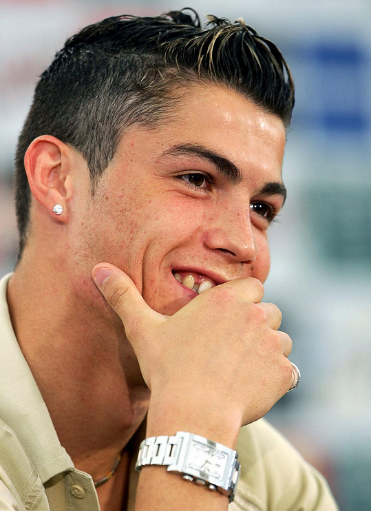 Cristiano Ronaldo se za své zuby styděl.