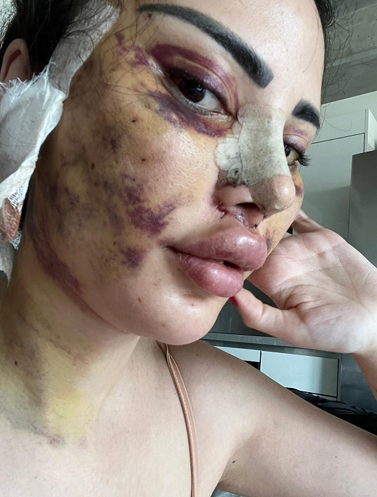Jennifer Pamplona dala svému obličeji i tělu za poslední roky pořádně zabrat. 