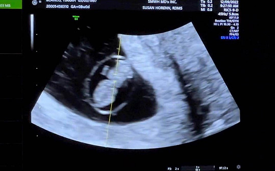 Dvojice se podělila o záběry z vyšetření ultrazvukem.