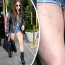 Lady Gaga hrdě předvádí v šortkách štíhlejší stehna. Ale co ty děsné podlitiny?