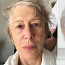 Přirozenost neskrývá: Slavná herečka (73) ukázala tvář před a po zkrášlení
