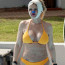 Herečka, která prošňupala miliony, po plastikách, jež jí zachránily obličej: S ovázanou hlavou se opalovala u bazénu