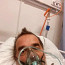 Miroslav Etzler skončil s covidovou atakou a zápalem plic v nemocnici: Nebyl jsem očkovaný, byla to chyba, napsal