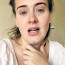 Adele skolila nemoc. Fanouškům se omlouvala za zrušení koncertu úplně ‚na přírodu‘
