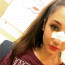 Po srážce s kolegyní při Plesu upírů skončila Natálie Grossová s nalomeným nosem: Máme foto