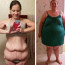 Obézní mamina zhubla metrák: Po dietě ale vypadala jako tající sněhulák
