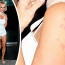 Pamela Anderson s podivnými fleky na rameni: Nemá doma s manželem Itálii?