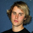 Justin Bieber je po rozchodu se Selenou Gomez zničený: Stres se projevil na jeho problematické pleti