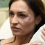 Cvičitelka Kynychová chce obličej jako dvacítka: Po zákroku chirurga to ale vypadalo trochu jinak