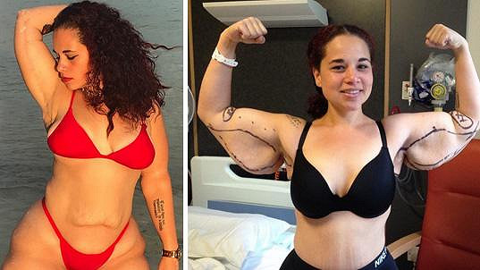 Váha Jessicy Wallace-Whitfield (28) z Baham se dostala až na nešťastných 134,5 kg.