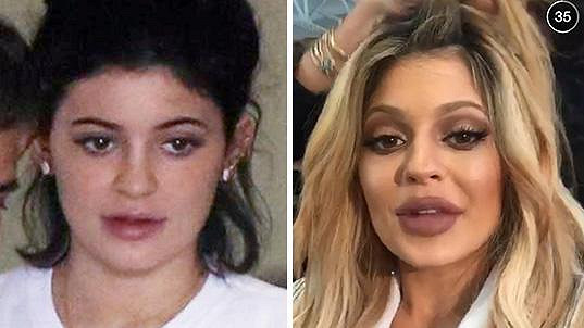 Dvě tváře Kylie Jenner